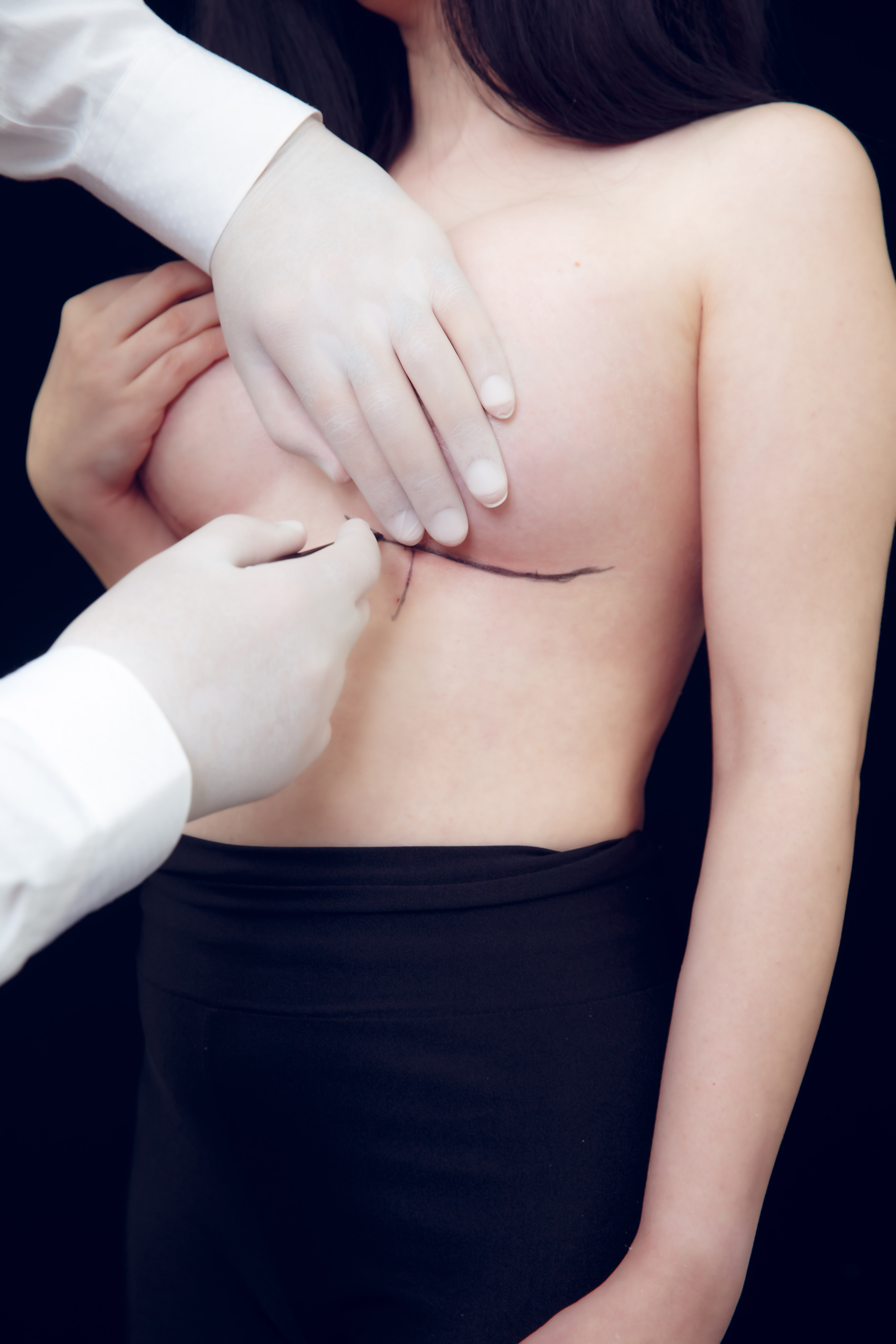 Oakland Body Contouring Model